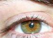 What is Hypnotherapy?